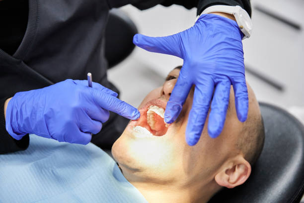 Best Emergency Tooth Extraction in Florissant, MO